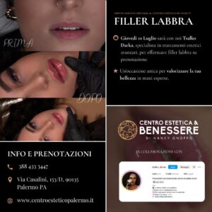 Filler-labbra-a-Palermo-al-CentroEstetico-by-Nancy2.